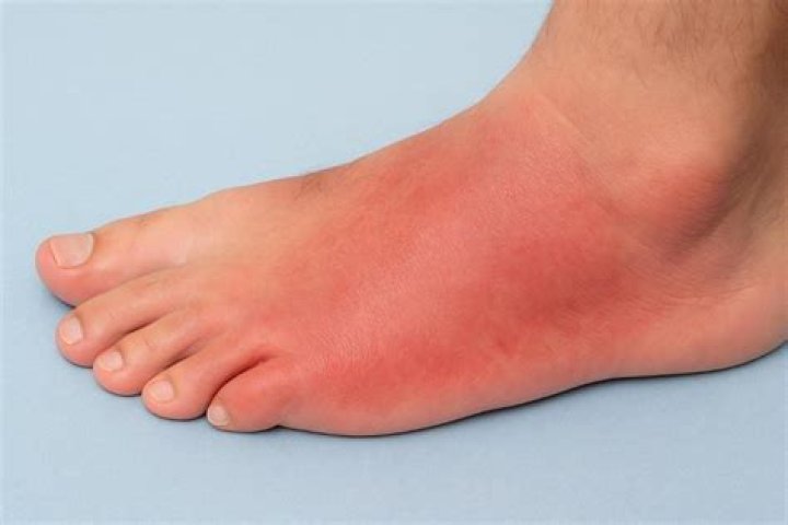 Can a foot infection make you sick?