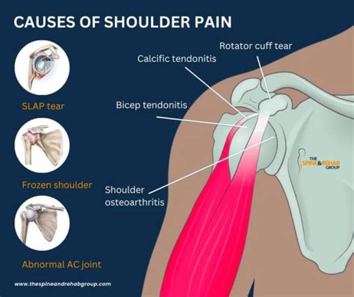 Can a port cause shoulder pain?