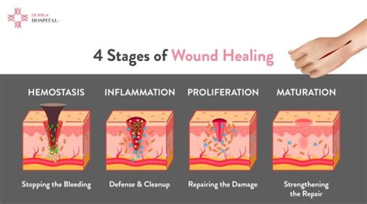 Can a wound heal and still be infected?