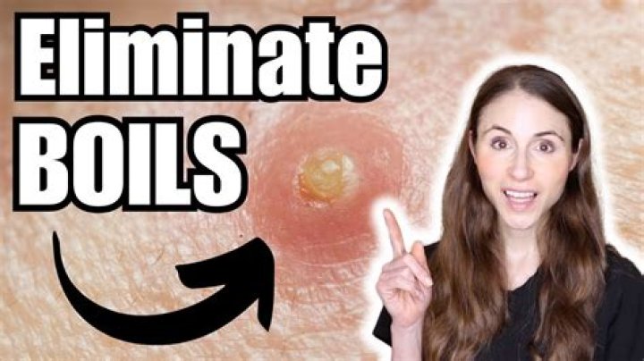 Do boils have black centers?
