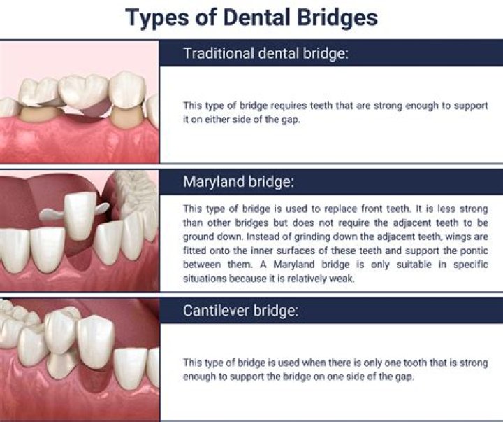 Do bridges look real?
