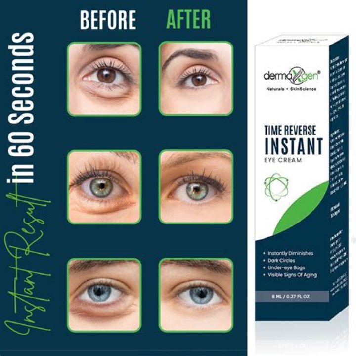 Does Himalaya eye cream reduces dark circles?