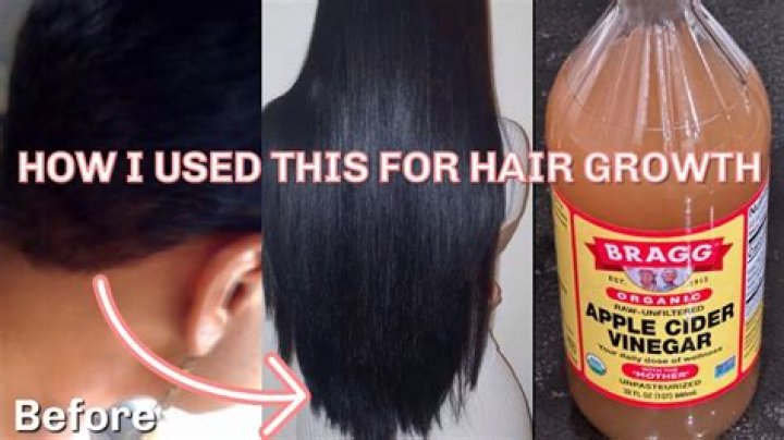 Does white vinegar make hair grow?
