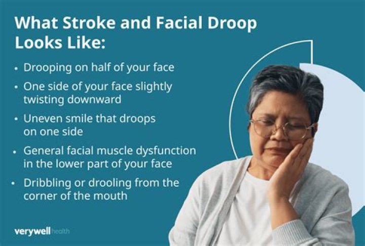 Does your face swell from a stroke?
