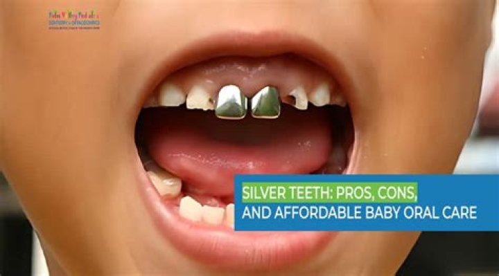 How long do silver teeth last?