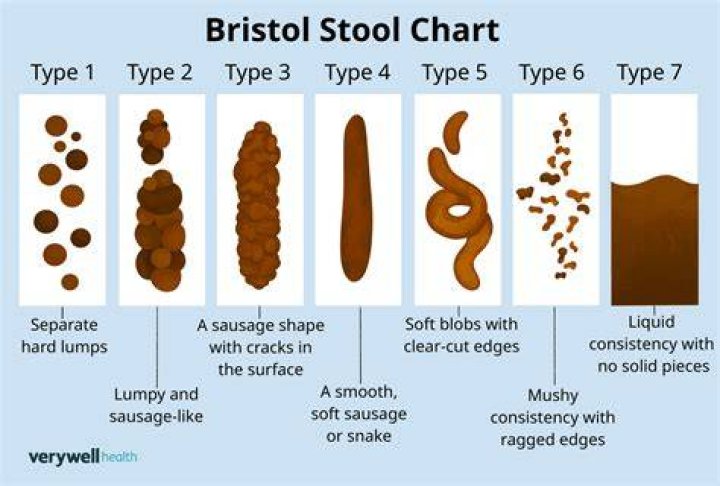 How long is too long to have loose stools?
