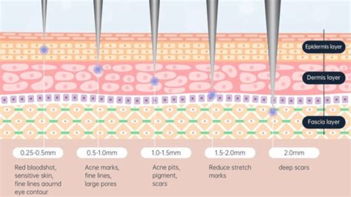 How often should I microneedle a scar?
