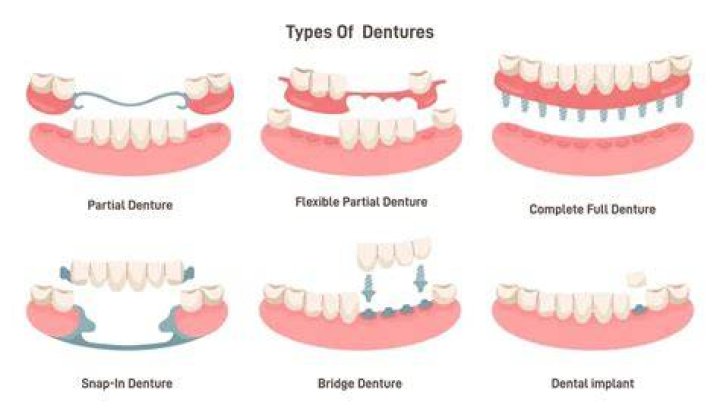 How painful are dentures?