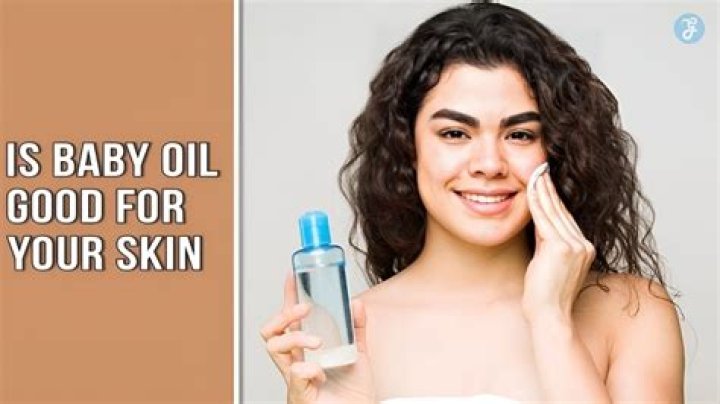 Is baby oil good for eczema?
