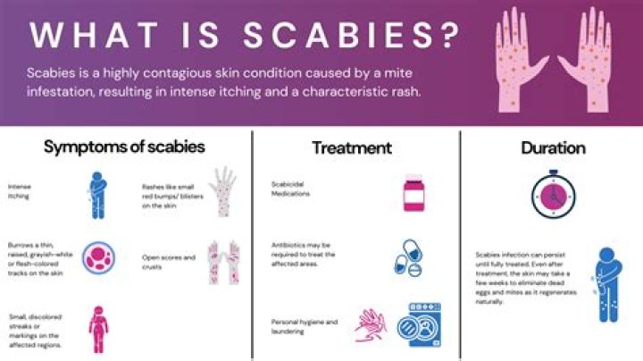 Is scabies caused by poor hygiene?