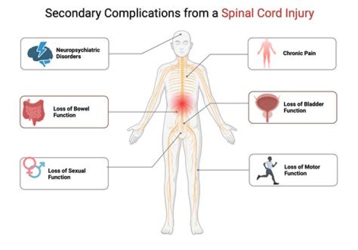 What are some secondary complications from sepsis?
