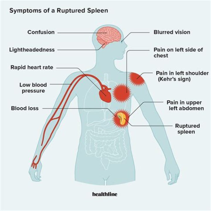 What are the symptoms of aflatoxin?