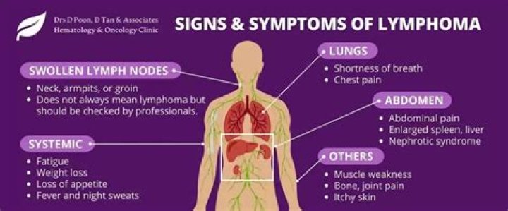 What does a lymphoma tumor look like?