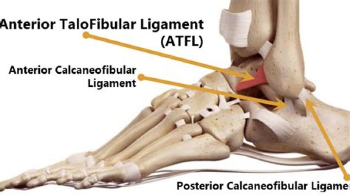 What does a torn ligament in the hip feel like?