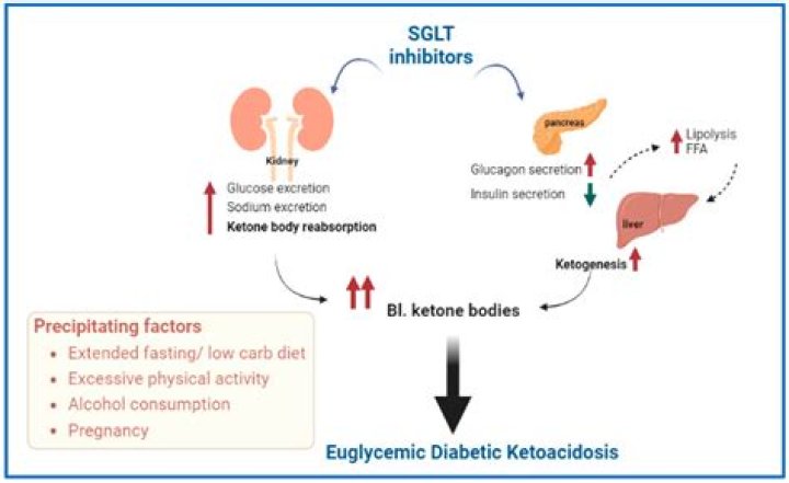 What does ketoacidosis smell like?