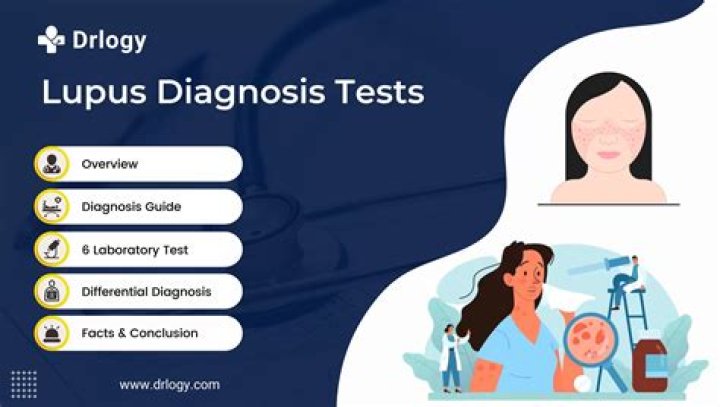 What does lupus do to the eyes?