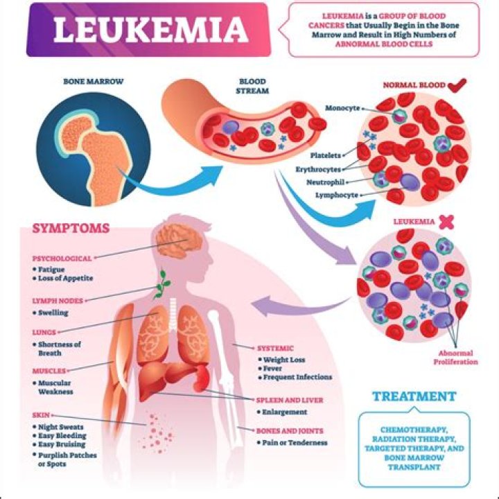 What if chemo doesn't work for leukemia?