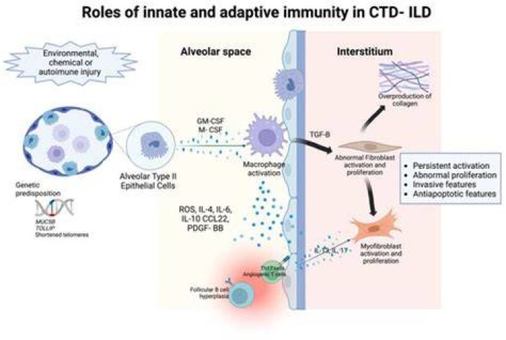 What is CTD disease?