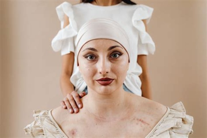Why are my scars white?