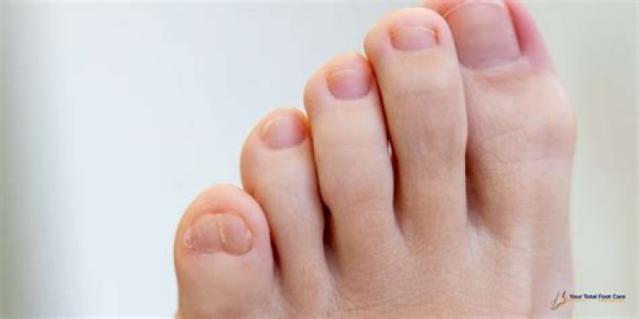 Why are pinky toenails small?