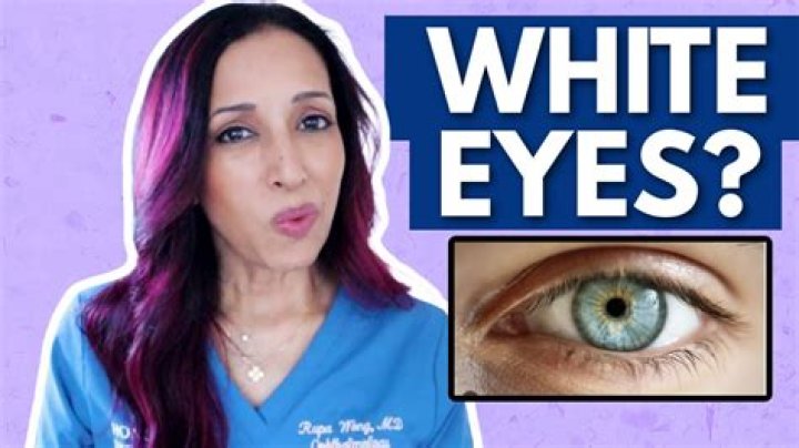 Why do I get white stuff in the corner of my eyes?
