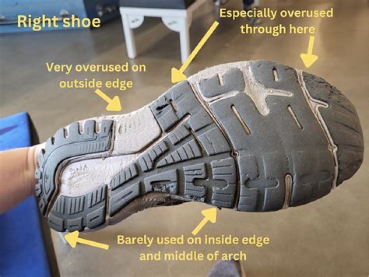 Why do my shoes suddenly feel tight?