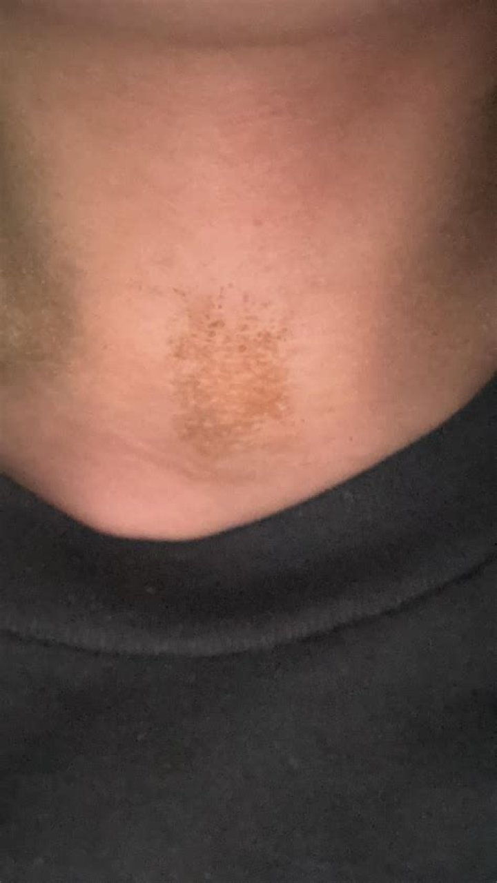 Why is my neck Brown?