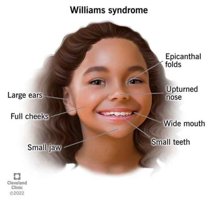 Will my child be nonverbal?